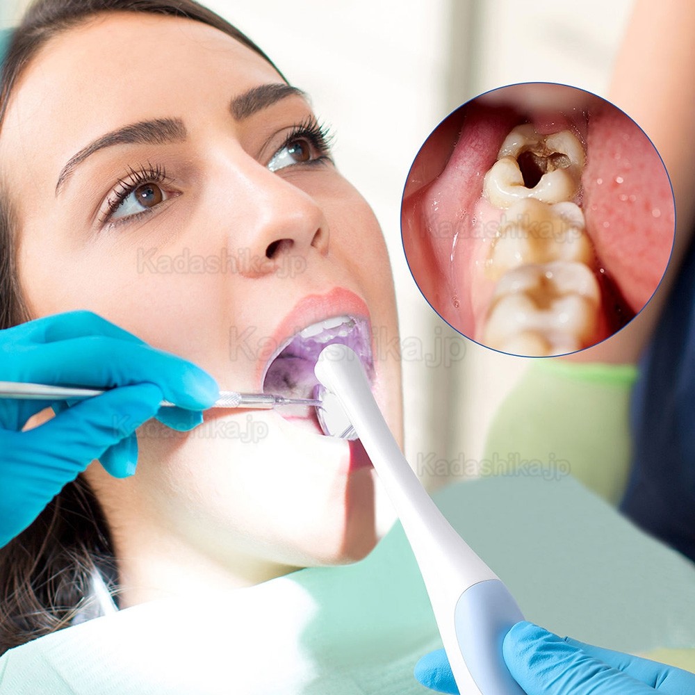 歯科用デジタル口腔内カメラ Type-C / Micro USB 2in1、2.0MPピクセル